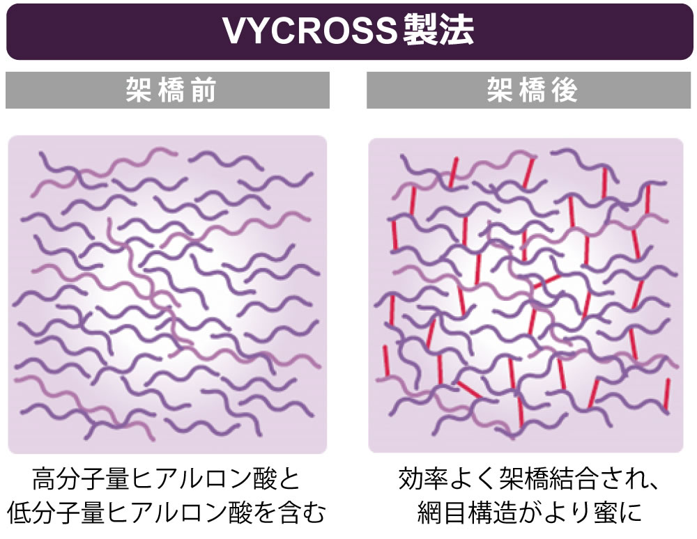 バイクロス技術