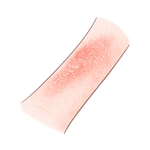 アトピー性皮膚炎・乾燥肌