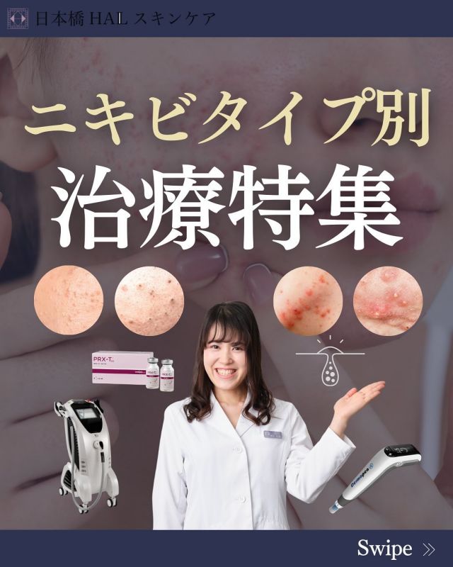 【ニキビタイプ別、治療特集👀】
気になるニキビタイプ別特集を致します‼️
ニキビのタイプは、1種類ではなく多くの種類が存在します。
ニキビタイプ別に適した治療法がございますので、是非この投稿をご覧になり綺麗になる近道を探してみてはいかがでしょうか🥰✨
，
ニキビ治療は、1回ではなく【継続的に行うからこそ】綺麗になる治療が多くあります。当院では、予算や症状に合わせてカスタマイズ治療をプランニングさせていただきます📝
，
ご予約は、
お電話☎️or LINEにてお待ちしております。

▼住所
 東京都中央区日本橋堀留町１丁目８−１０ 三ツ美ビル 4階

▼電話番号
０３-６２３１-１１８６

#ニキビ治療 #美容医療 #美容クリニック #美容皮膚科 #日本橋美容クリニック #赤ニキビ #白ニキビ #黒ニキビ #炎症ニキビ #ダーマペン